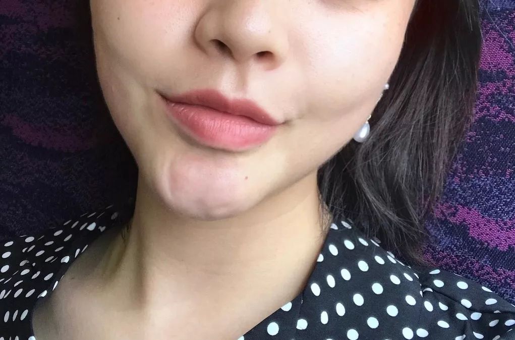 澳洲美白丸推荐,澳洲美白丸真的有效吗