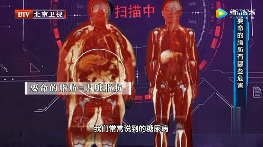 看不见的肥胖更要命！脂肪长在这里最危险，简单一招，快速瘦！