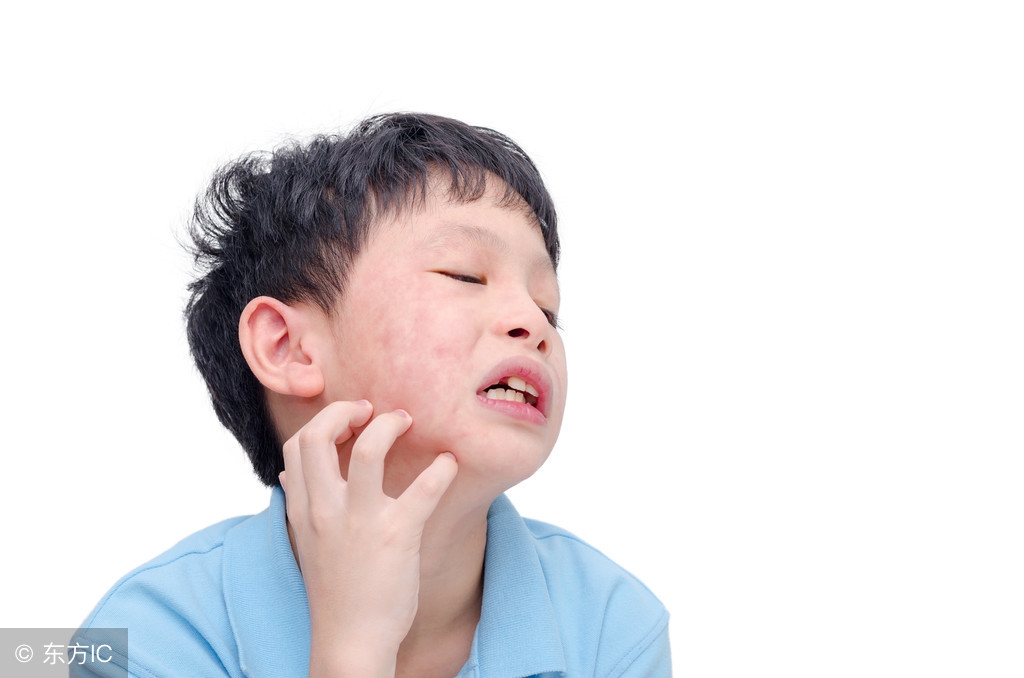 慢性荨麻疹可以打麻疹风疹疫苗吗,慢性荨麻疹怎么治疗最快止痒