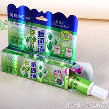 祛痘痘秘诀学生,最有效的祛痘痘方法图片