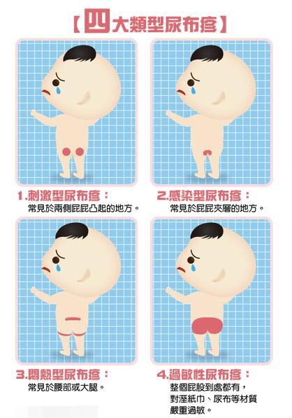 尿布疹的正确护理方法,出现尿布疹如何护理