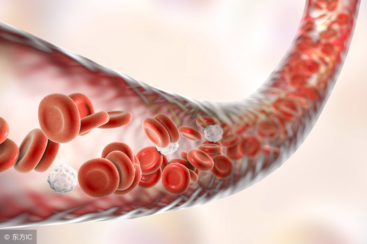 血管斑块堵住血管还能疏通开吗,小血管堵住没事大血管堵住没治