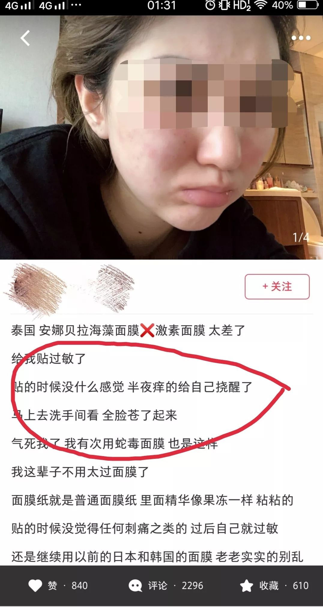 泰国面膜骗局揭秘,泰国ray面膜被爆含激素