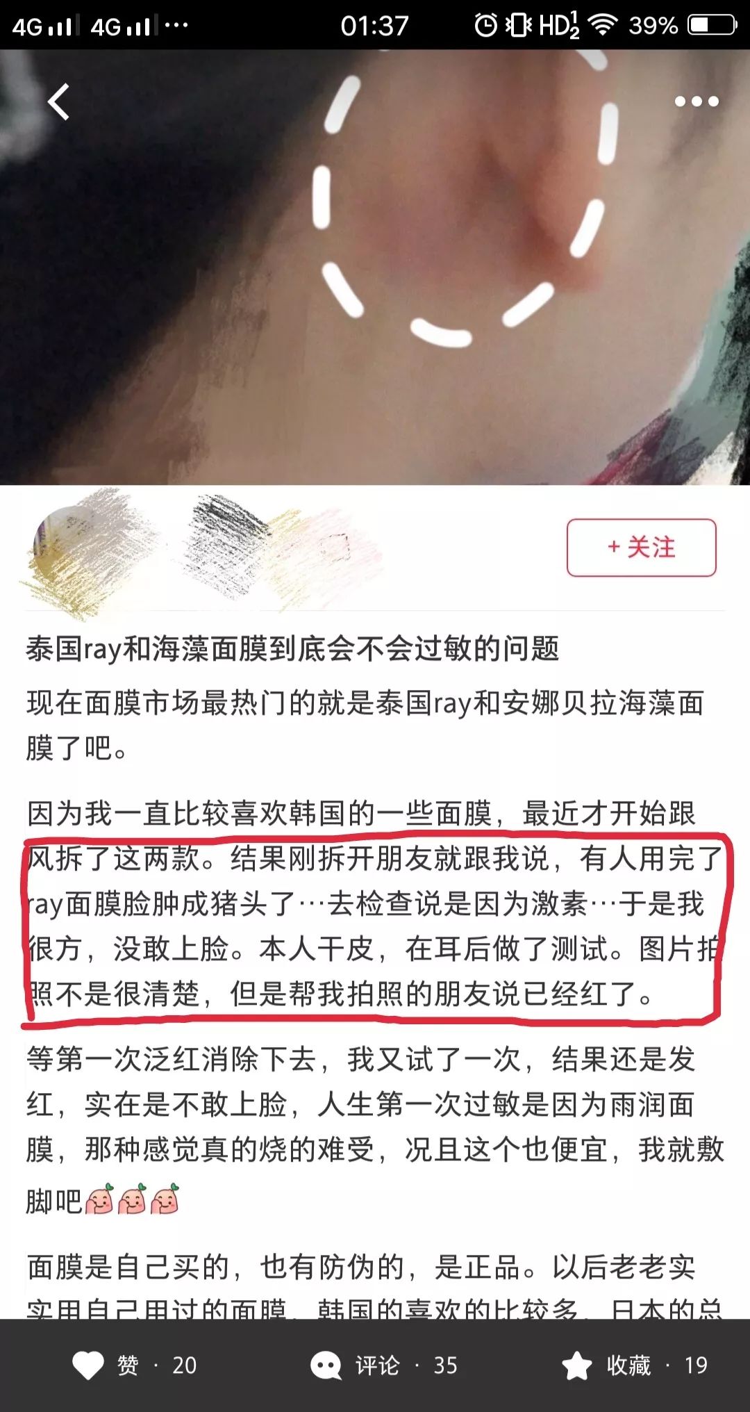 泰国蛇毒面膜真的全是激素吗,泰国蛇毒面膜真的假的