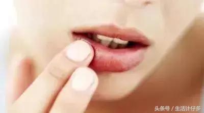 嘴唇开裂让你丑10倍，不花1分钱一招立刻变水润！