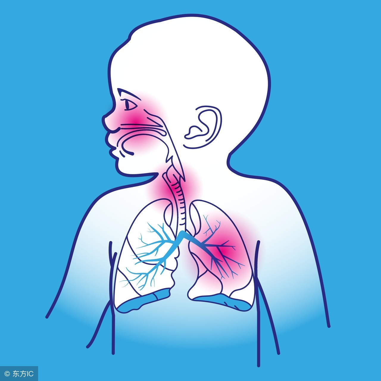 支原体感染需要做哪方面的检查