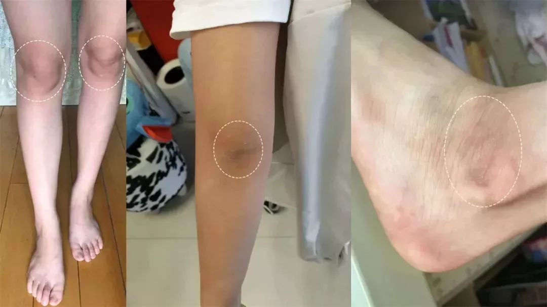 洗屁屁变白的香皂,洗屁屁香皂真的会变白吗