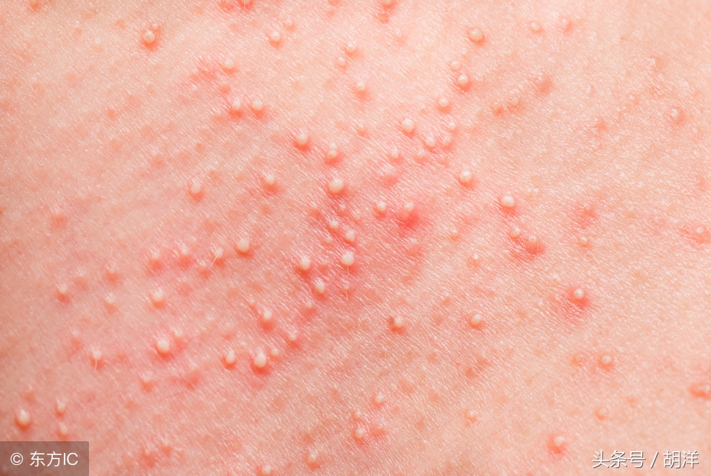 靶向药也治不好癌症吗,靶向药治疗肿瘤晚期成功率有多大