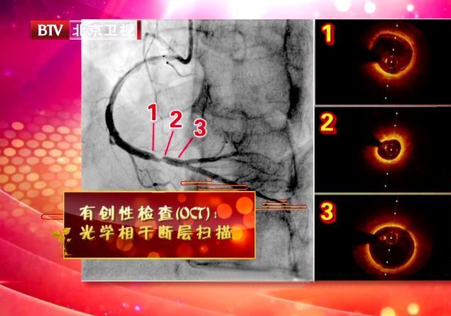 胸痛突发,感到胸痛要警惕四种病