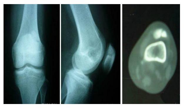 常见的十大膝关节疼痛,老年患者膝关节疾病健康科普