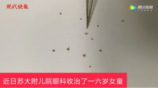 幼儿睫毛根部长虫是怎么回事,小孩眼睫毛有虫子