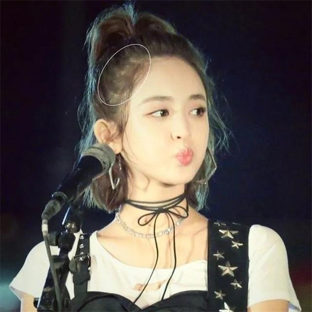 一个方法判断你是否有脱发,造成脱发的原因无非就这5个