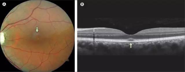 在基友圈中比“0号胶囊”还流行的Rush是不是*品毒**？有什么危害？