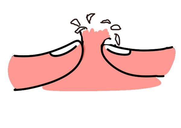 怎么挤痘痘才不会留痘坑,怎么挤痘痘不会留痘印痘坑