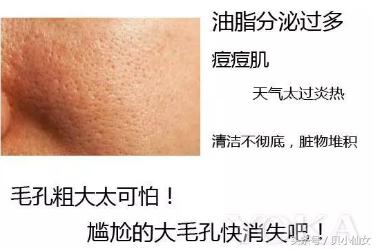 怎么才能让毛孔消失呢,怎么拯救我的毛孔