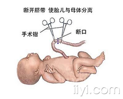 剖腹产的麻醉针,剖腹产最多可以剖几次