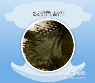 婴儿10-12个月粪便颜色,婴幼儿正常大便的颜色和性状