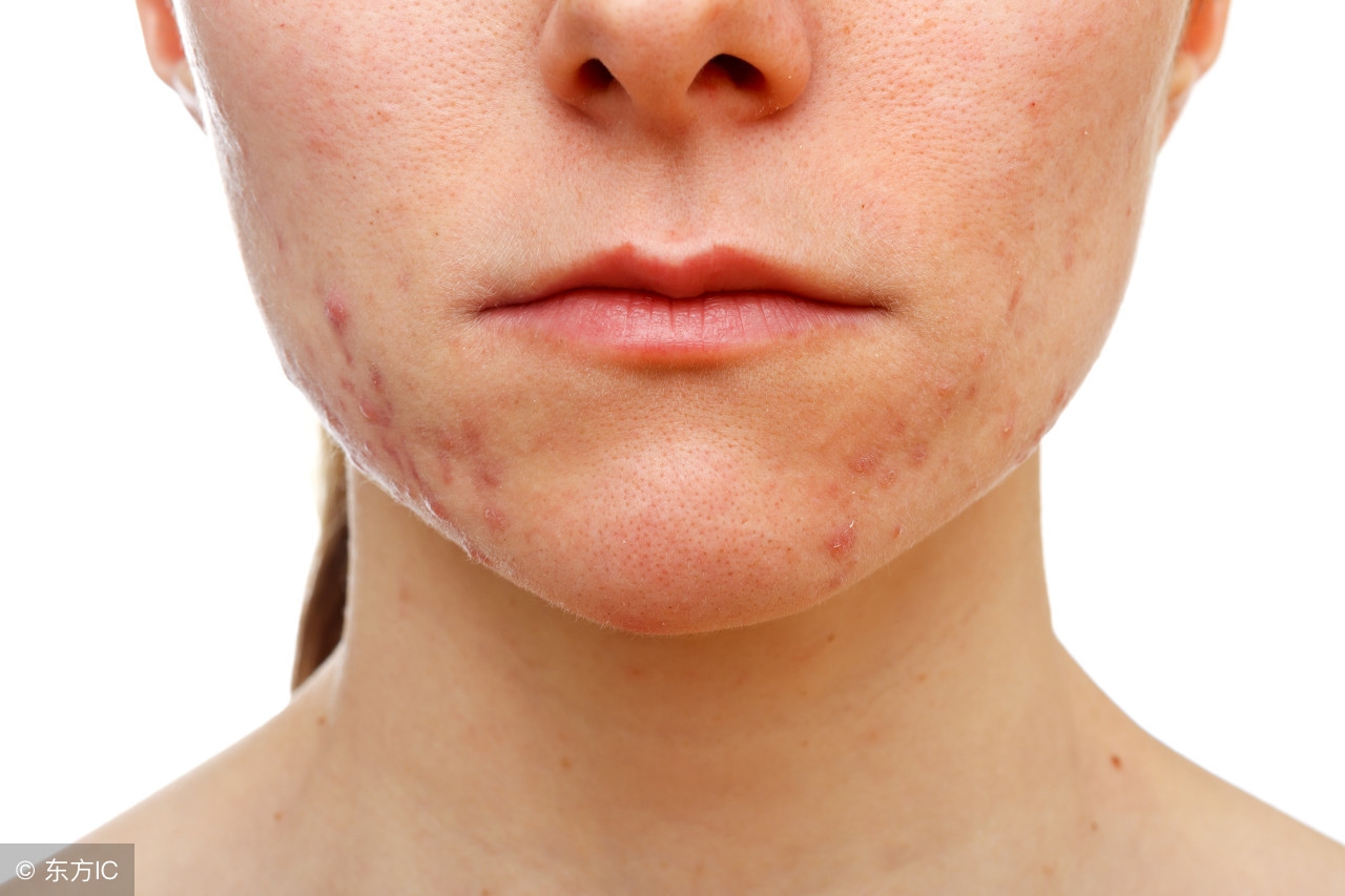 城野医生vc精华收缩毛孔好用吗,使用城野医生的轻酸能收缩毛孔吗