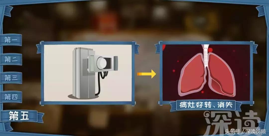 咳嗽低烧37.1-37.5要警惕,咳嗽低烧警惕四种病