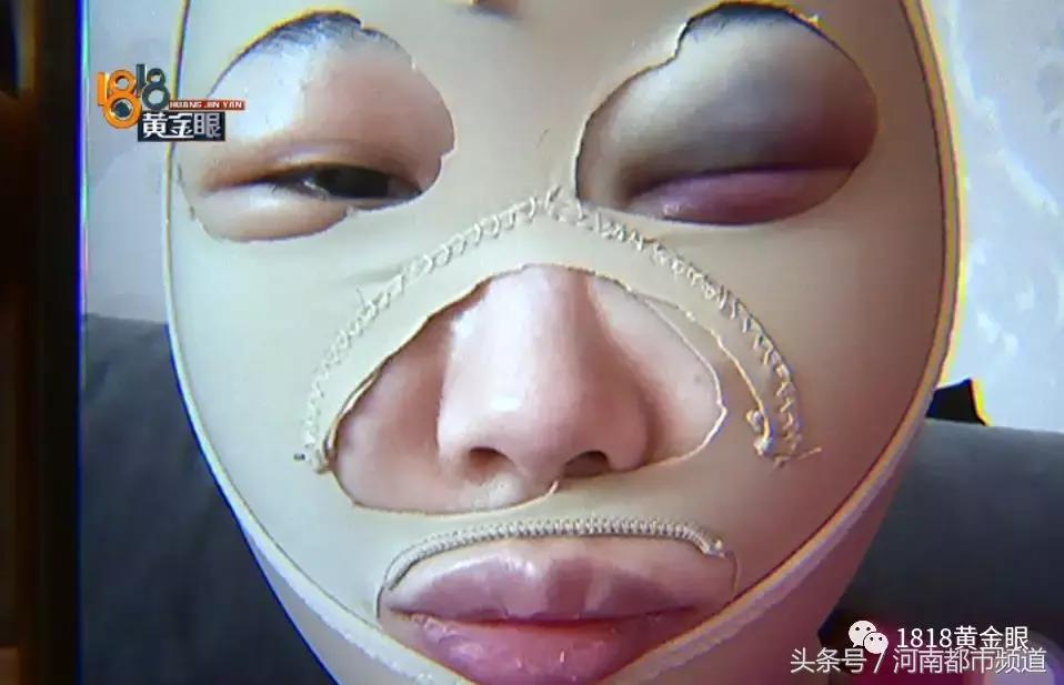 为什么我做溶脂瘦脸都没效果,为什么溶脂瘦脸15天才有效果