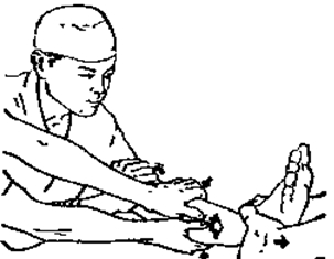 中医骨折治疗原则,中医骨伤整复术