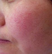 有了全世界3秒卖一瓶的“液体黄金“，干燥、长痘就与你无缘了！