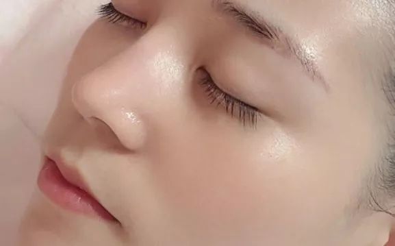 有了全世界3秒卖一瓶的“液体黄金“，干燥、长痘就与你无缘了！