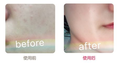 有了全世界3秒卖一瓶的“液体黄金“，干燥、长痘就与你无缘了！