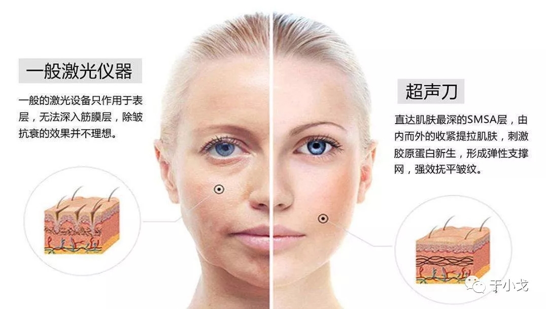 微商胶原蛋白是真的吗,微商胶原蛋白骗局揭秘