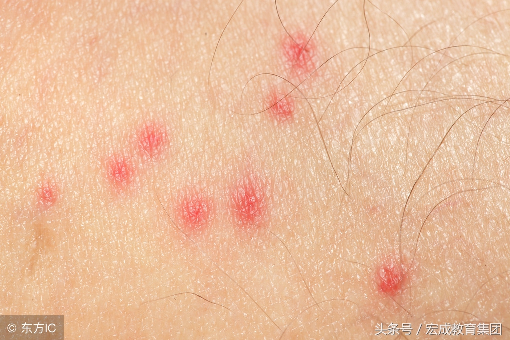 宝宝常见的皮肤病用药,常见皮肤病用药药膏有哪些