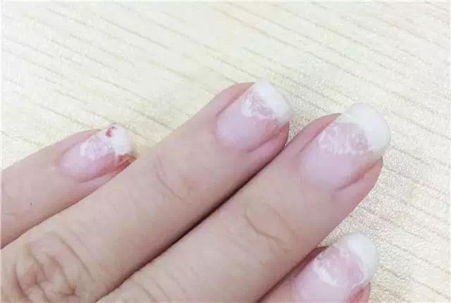 美甲小知识指甲可以抠掉吗,指甲薄可以做美甲吗