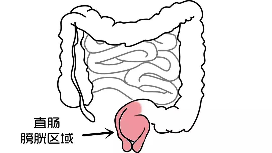 肚子疼都是哪里的问题图,肚子疼到底是哪里痛