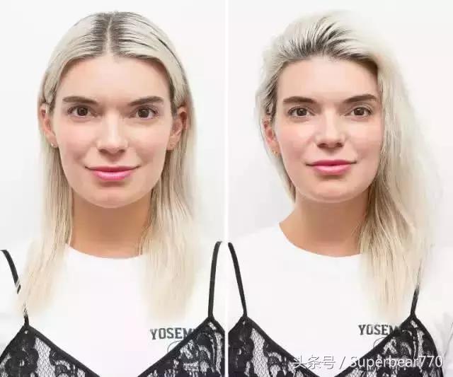 头顶头发又细又软又少怎么办,头发少又细又软适合什么发型