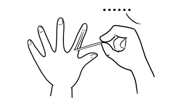 指甲上月牙越来越少是怎么回事,指甲半月牙少是怎么回事