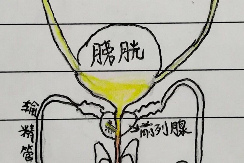 引起血尿的原因一定是肾有问题吗,引起血尿的原因有哪些