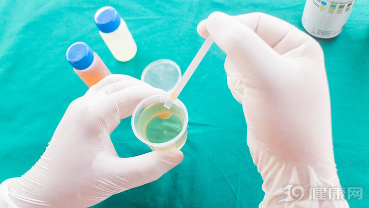 肾病小便泡沫多怎么回事,小便泡沫多是尿毒症么