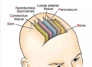 头上长瘤一般恶性的还是良性的,婴儿脑袋长个瘤会不会看出来