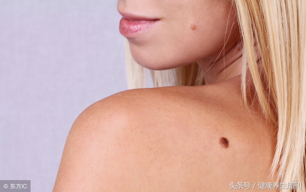 人中有痣的男人是福是祸,鼻子旁边有瘊子的人是福还是祸