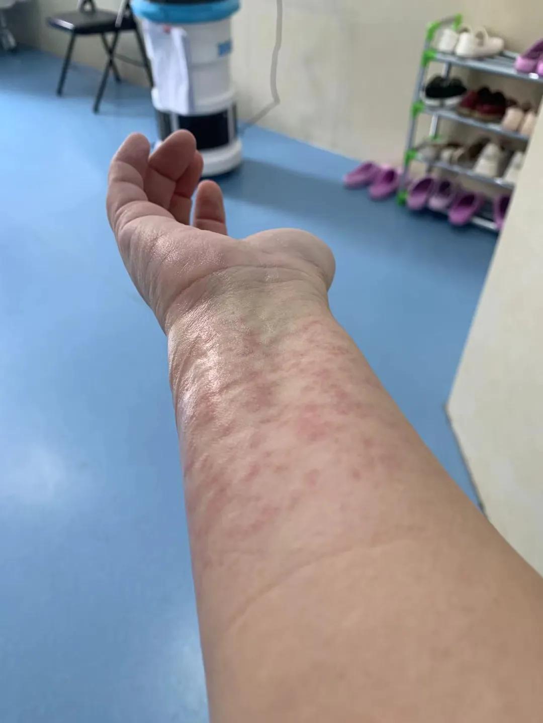 【我和我的荣耀】高孟秋：为国抗疫，我骄傲