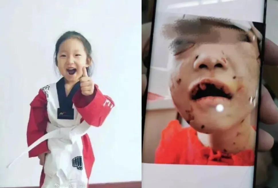 儿童安全教育小技巧,儿童安全教育100个细节