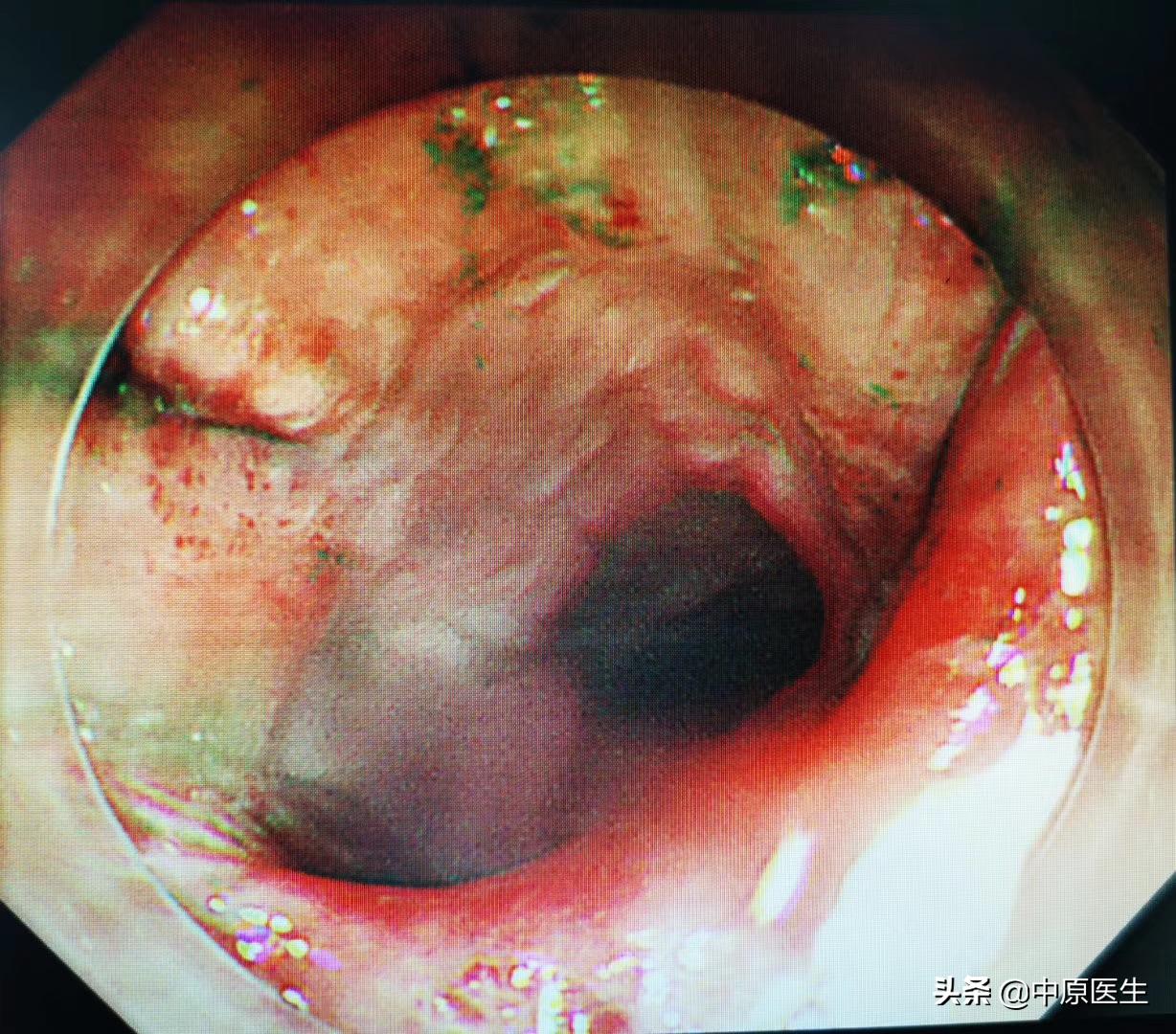 老人只吃保健品吃进了医院,老人吃保健品住进医院