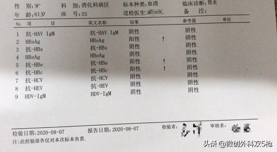 老公有乙肝大三阳还天天喝啤酒,老公有乙肝喝酒怎么办