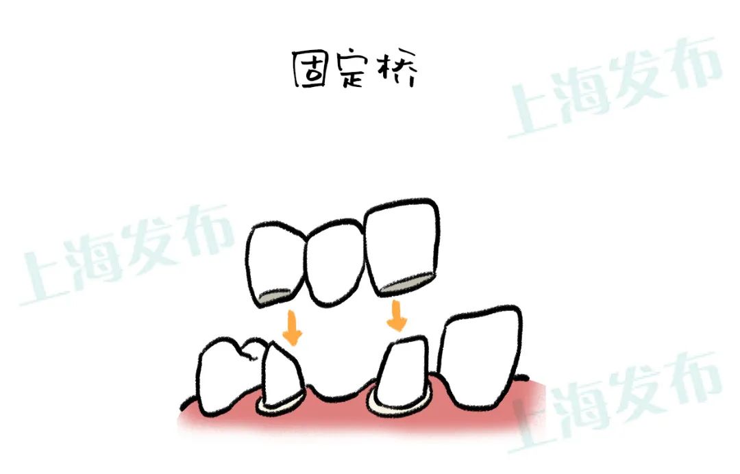 怎样缓解牙疼引起的牙神经疼痛,关于牙疼健康问题的对话简短