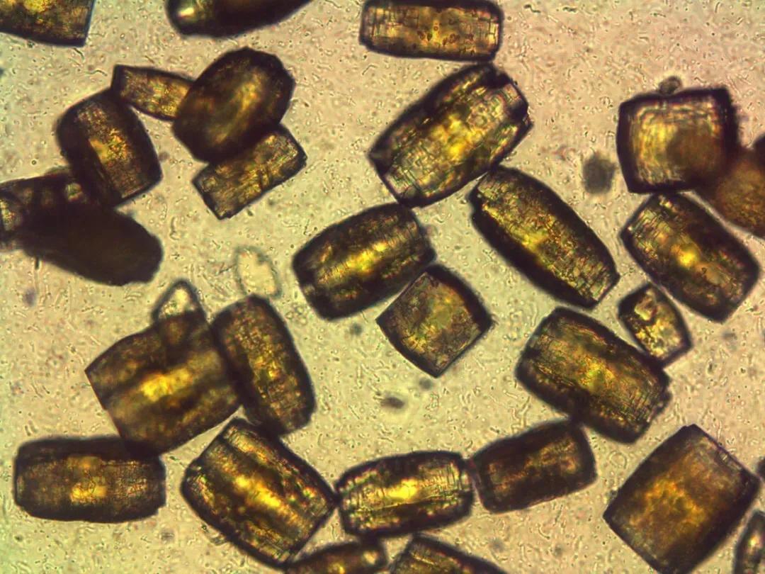 看尿酸化验单,检查尿酸600以上的图片