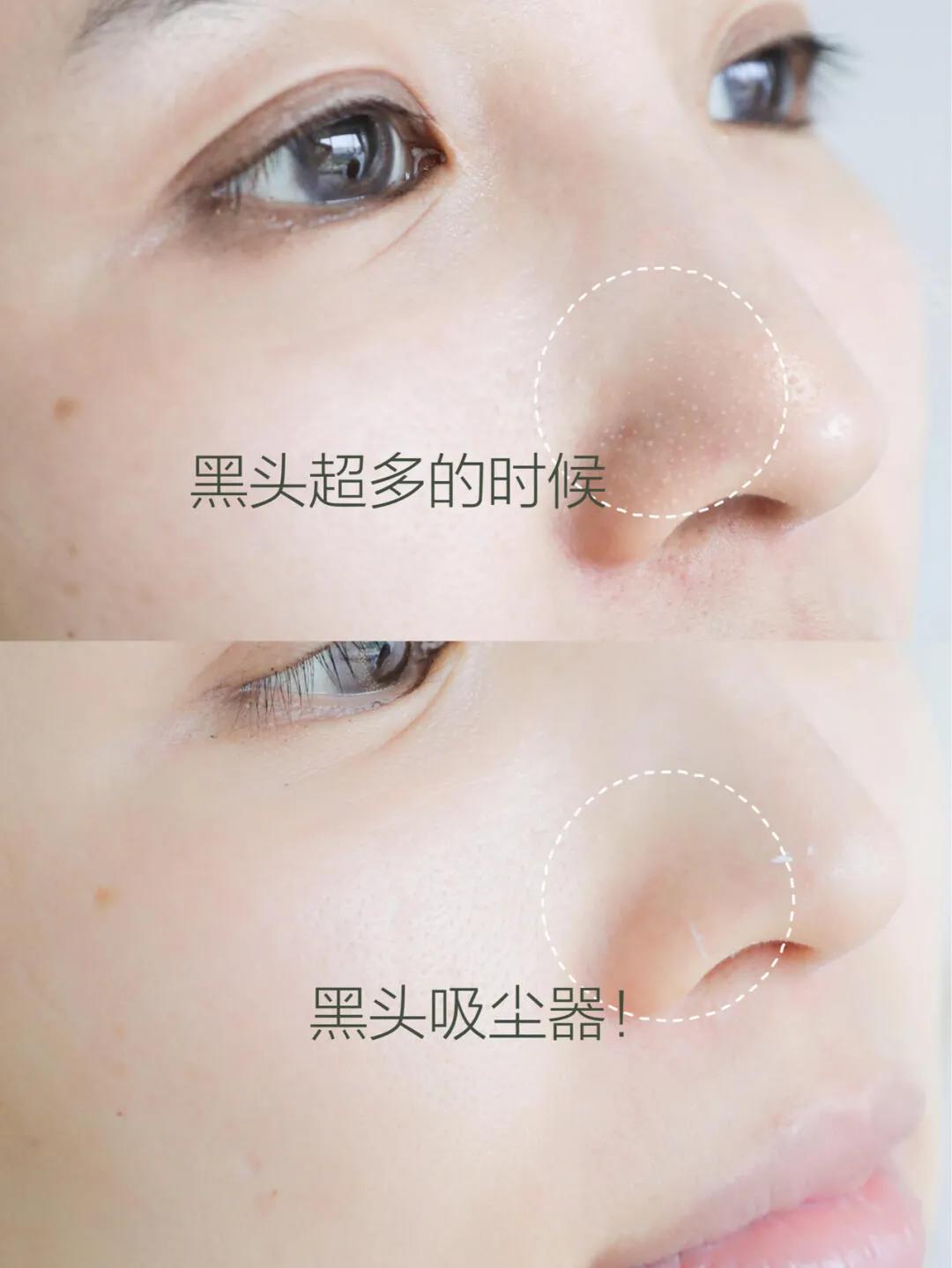 科颜氏面膜使用顺序,科颜氏面膜三部曲