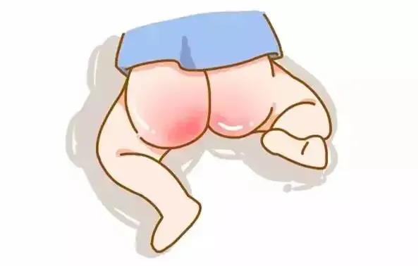 宝宝红屁股了该怎么护理好,宝宝红屁股了怎样护理能快速好