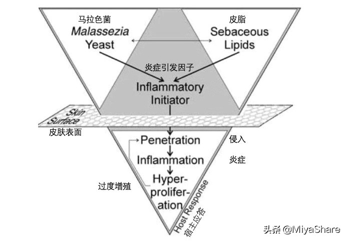 头屑太多了怎么办怎么洗也洗不掉,雪花一样的头屑怎么去除