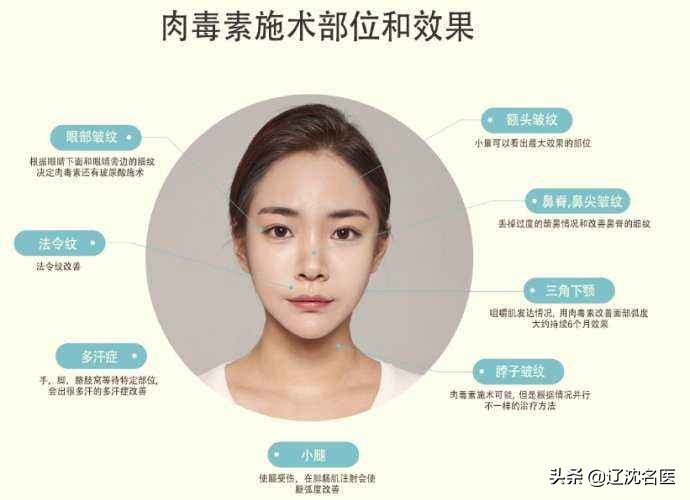 注射玻尿酸美容整形,微整形玻尿酸注射方法图解