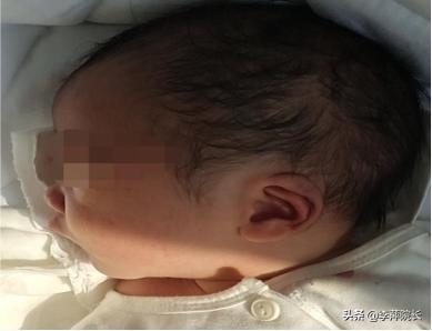 女人囊肿要不要治疗,菏泽姑娘婚后2年不孕各种心酸