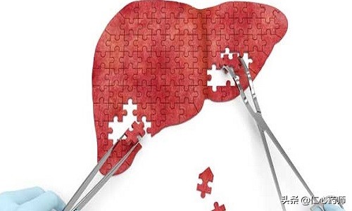 乙肝最新治疗方法联合用药法,治疗慢性乙肝用什么药好